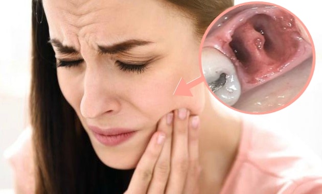 Paciente con tratamiento de ortodoncia